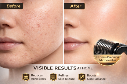 Premium Derma Microneedle Roller